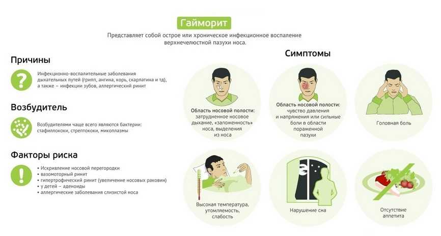 Гайморит инфографика