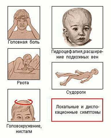 Отёк мозга у ребенка