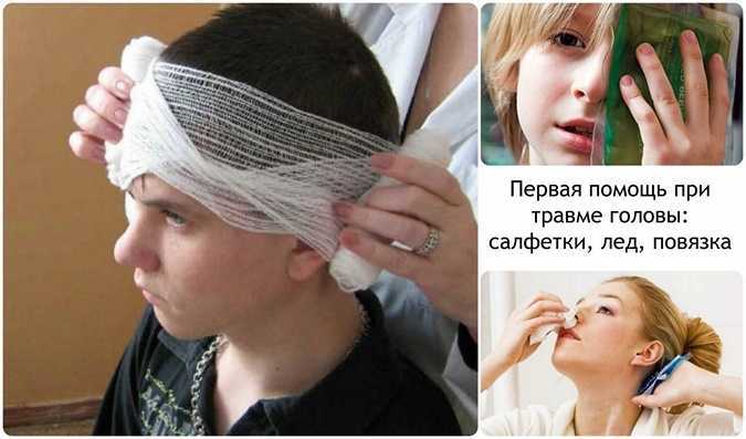 Первая помощь при травме головы у ребенка