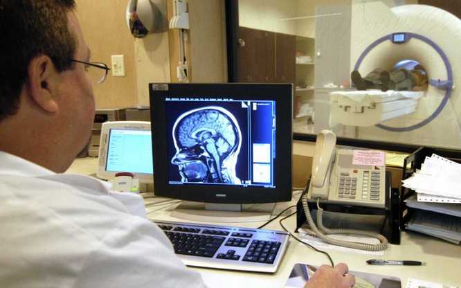 шум в голове - МРТ головы